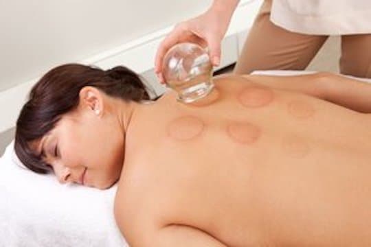 Cupping